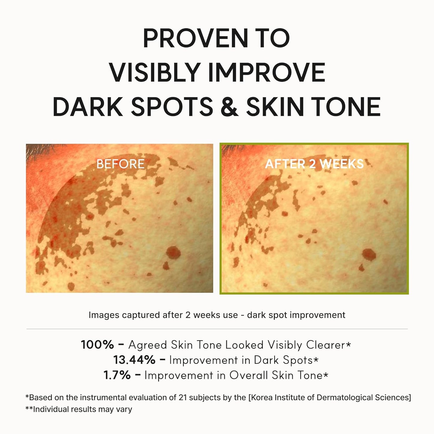 Arencia Vitamin C Booster Shot Serum for Dark Spot & Glow Care